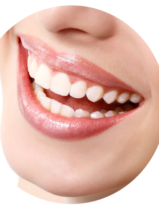 Transform Your Smile with Tooth Bonding at Montclair Dental Care