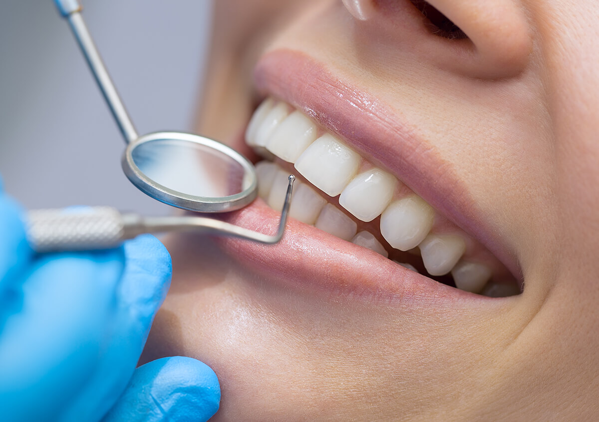 Teeth Filling Dentist in Oakland Area