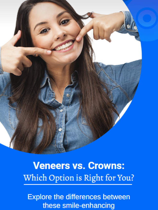 Veneers vs. Crowns